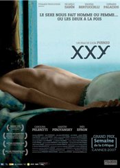   XXY